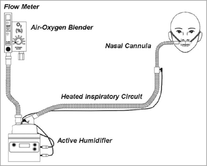 Lợi ích của máy thở oxy dòng cao HFNC